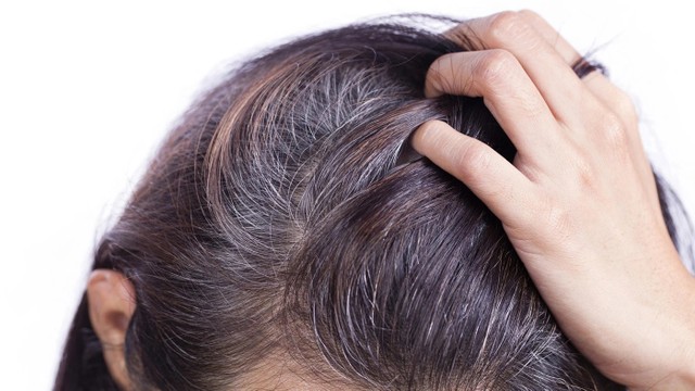 bai-viet/toc-bac-som-thieu-chat-gi.html