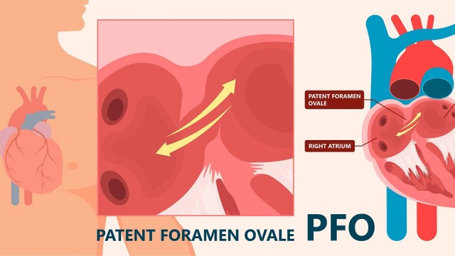 bai-viet/tinh-trang-ton-tai-lo-bau-duc-trong-tim-co-nguy-hiem-khong.html