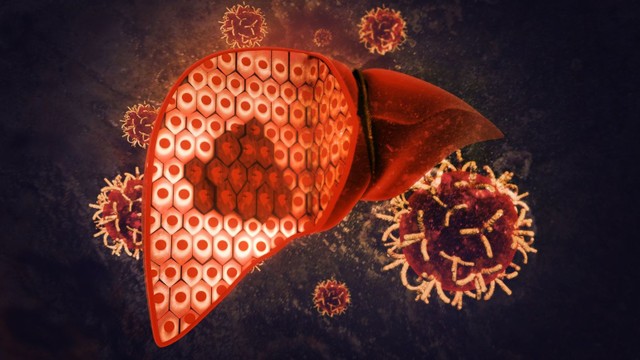 bai-viet/ton-thuong-gan-nguyen-nhan-trieu-chung-va-cach-phong-ngua.html