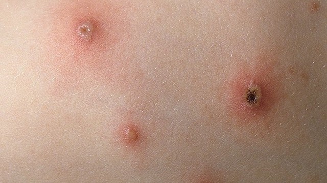 bai-viet/tong-hop-hinh-anh-thuy-dau-qua-cac-giai-doan.html