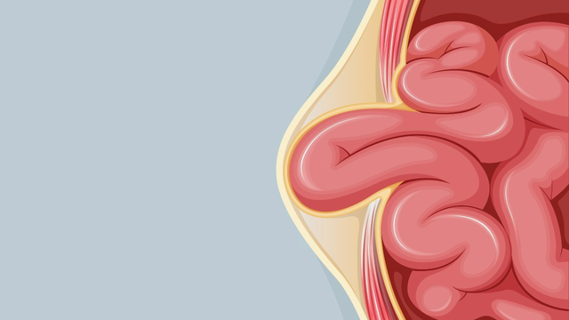 bai-viet/tong-quan-ve-chung-sa-ruot.html