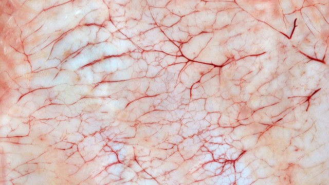 bai-viet/tong-quan-ve-mao-mach-nhung-dieu-ban-nen-biet.html