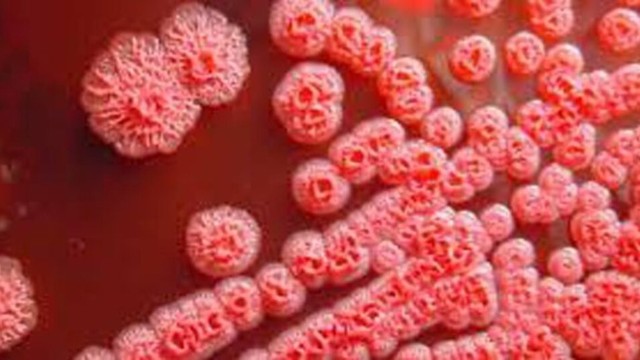 bai-viet/top-5-cach-phong-benh-whitmore-theo-khuyen-cao-tu-bo-y-te.html