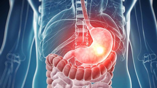 bai-viet/dau-la-nhung-thuoc-chua-viem-loet-da-day-tot-nhat-hien-nay.html