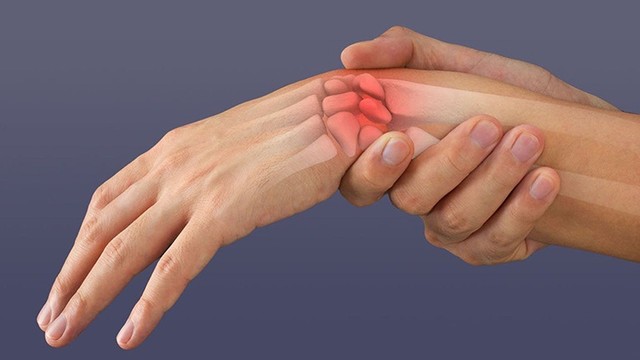 bai-viet/trat-khop-co-tay-co-can-bo-bot-khong-58134.html