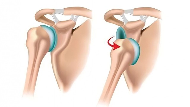 bai-viet/trat-khop-co-tu-khoi-duoc-khong-truong-hop-nao-can-den-benh-vien.html