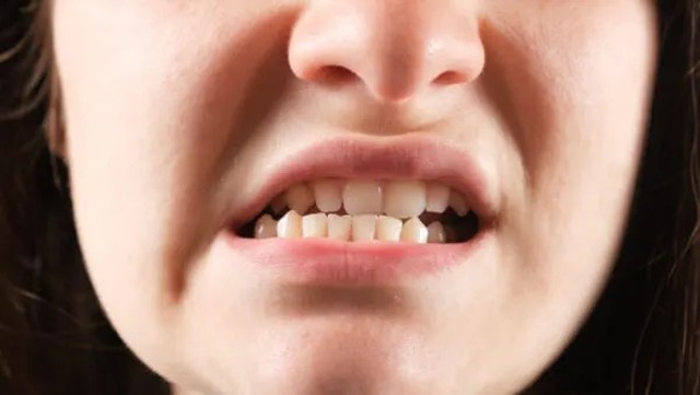 bai-viet/trat-khop-ham-bieu-hien-nguyen-nhan-dieu-tri-va-cach-phong-ngua.html