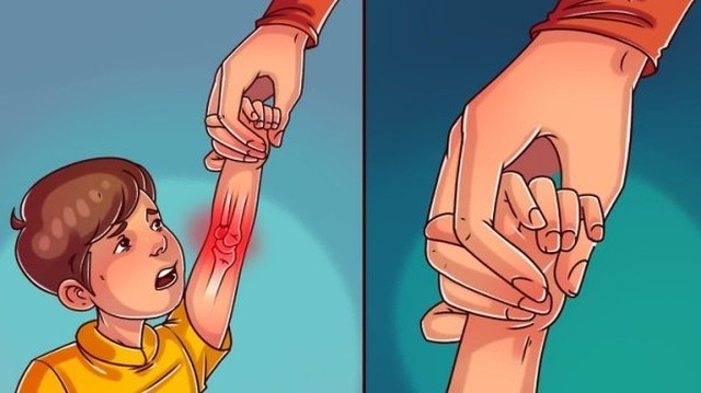 bai-viet/trat-khop-khuyu-tay-tre-em-chan-thuong-cuc-ky-nguy-hiem-58464.html