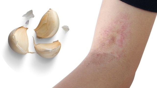 bai-viet/meo-tri-hac-lao-bang-toi-mang-don-gian-mang-den-hieu-qua-cao.html