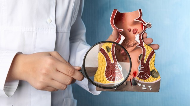 benh/tri-ngoai-1282.html