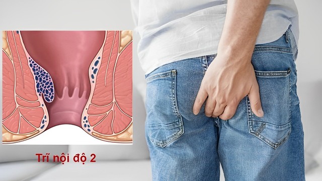 bai-viet/tri-noi-do-2-co-chua-khoi-duoc-khong.html