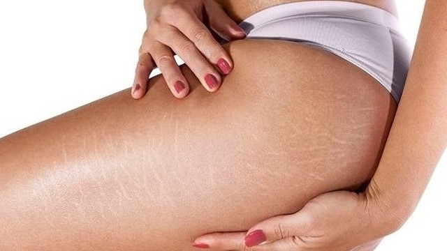 bai-viet/tri-ran-da-mong-lau-nam-co-hieu-qua-khong-cach-chua-the-nao-56538.html