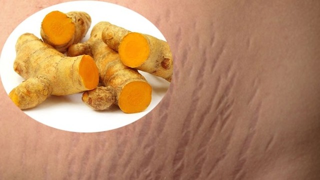 bai-viet/tri-ran-da-sau-sinh-bang-nghe-tuoi-chi-tiet-a-z-57049.html