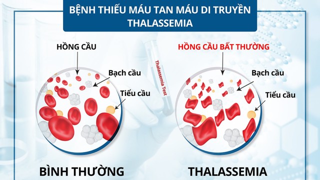 bai-viet/thieu-mau-bam-sinh-nguyen-nhan-trieu-chung-va-cach-dieu-tri.html