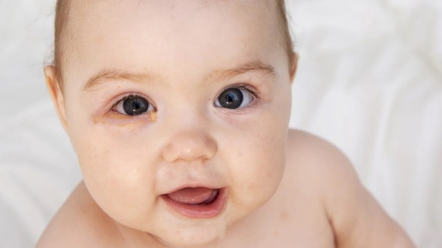 bai-viet/trieu-chung-dau-mat-do-o-tre-em-phu-huynh-can-luu-y-dieu-gi.html