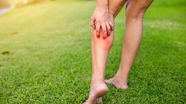 bai-viet/trieu-chung-khi-bi-con-trung-can-va-cach-xu-ly-hieu-qua-68983.html