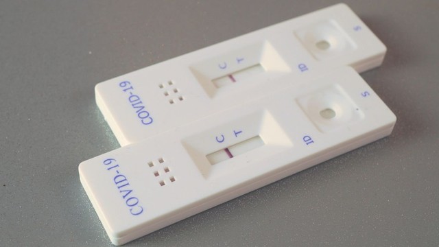 bai-viet/trieu-chung-covid-19-theo-tung-muc-do-benh-tu-nhe-den-nang.html