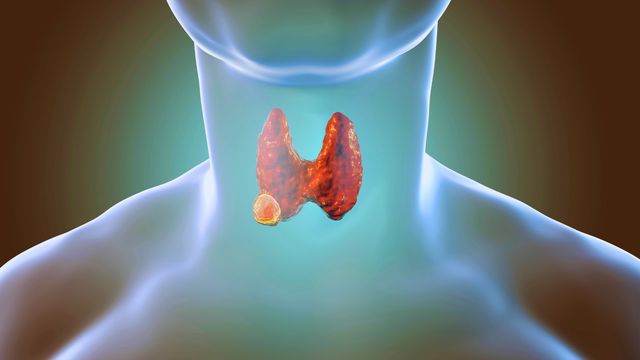 bai-viet/trieu-chung-u-tuyen-giap-lanh-tinh-va-nhung-dieu-can-biet.html