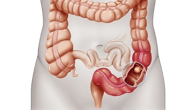 bai-viet/truc-trang-la-gi-cau-tao-chuc-nang-va-cac-benh-ly-thuong-gap.html