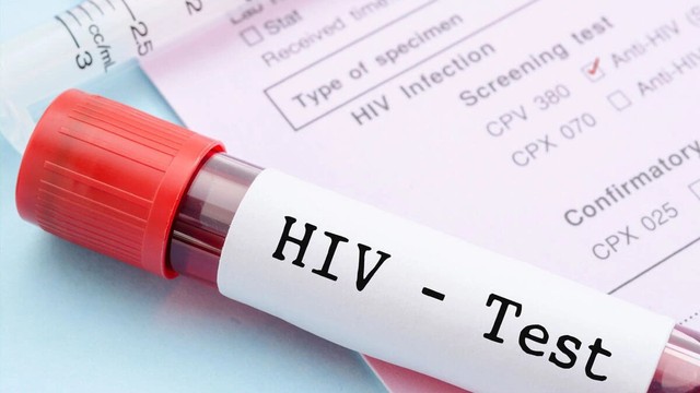 bai-viet/truoc-khi-phau-thuat-co-xet-nghiem-hiv-khong-bien-phap-phong-tranh-lay-nhiem-hiv.html