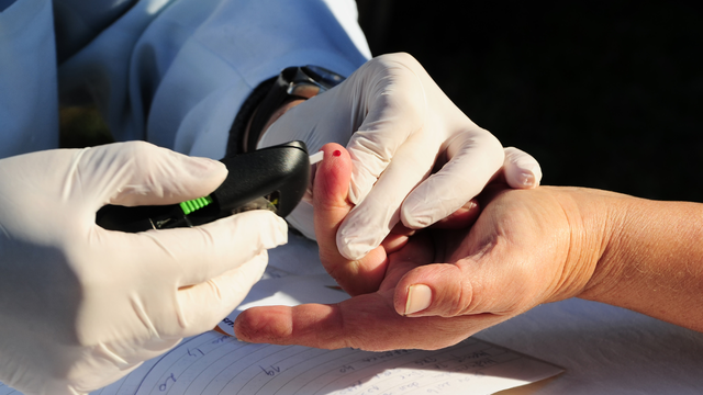 bai-viet/truoc-khi-xet-nghiem-tieu-duong-co-can-nhin-an-hay-khong.html