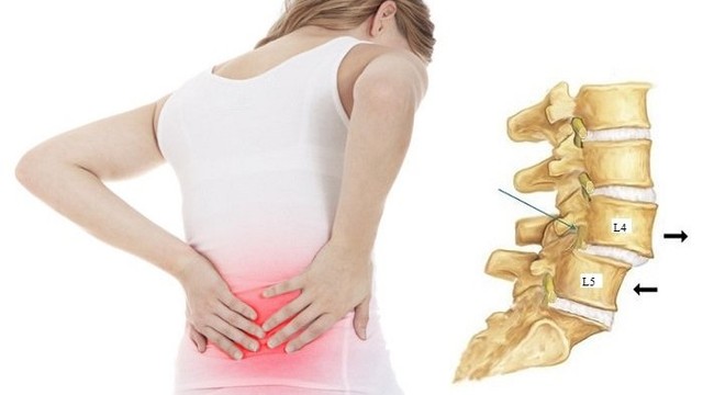 bai-viet/truot-dot-song-that-lung-va-nhung-dieu-nguoi-benh-can-chu-y.html