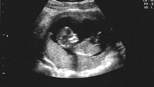 bai-viet/tu-dich-mang-nuoi-nguyen-nhan-va-cach-dieu-tri-67427.html