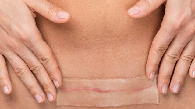 bai-viet/tu-dich-vet-mo-nguyen-nhan-va-cach-phong-ngua.html