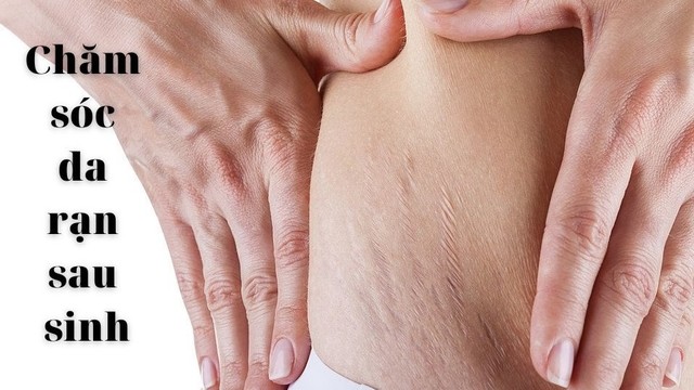 bai-viet/tu-van-cham-soc-ran-da-sau-sinh-dung-cach-56870.html