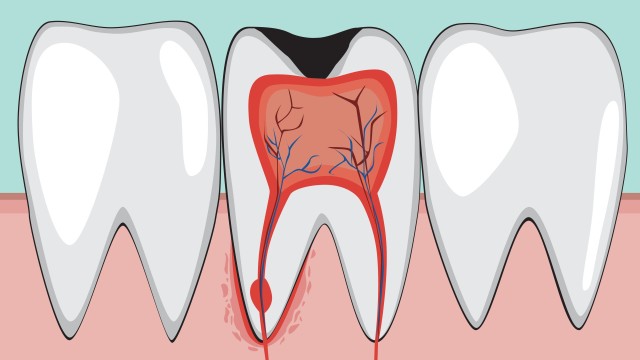 bai-viet/tuy-rang-cau-tao-vai-tro-va-benh-ly-thuong-gap.html