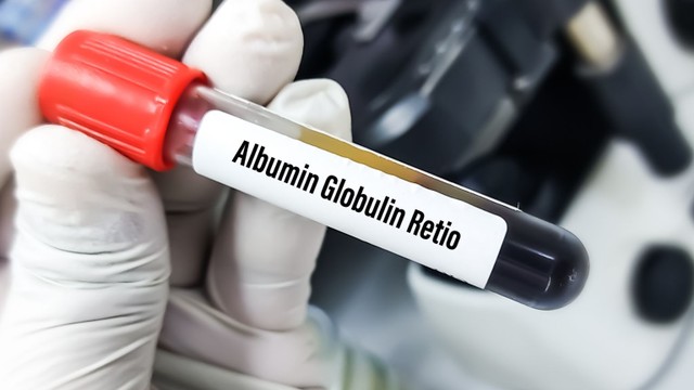 bai-viet/ty-le-albumin-globulin-la-gi-y-nghia-cua-ty-le-albumin-globulin-trong-chan-doan-va-theo-doi-benh.html