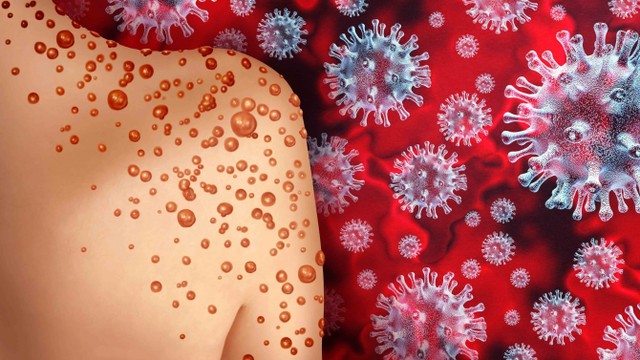 bai-viet/ty-le-tu-vong-cua-benh-dau-mua-khi-va-cac-bien-phap-phong-ngua-hieu-qua.html