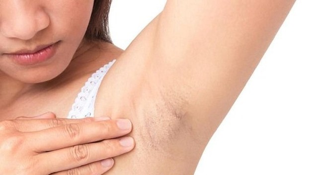 bai-viet/u-ba-dau-o-nach-co-nguy-hiem-khong-cach-dieu-tri-u-ba-dau-o-nach.html