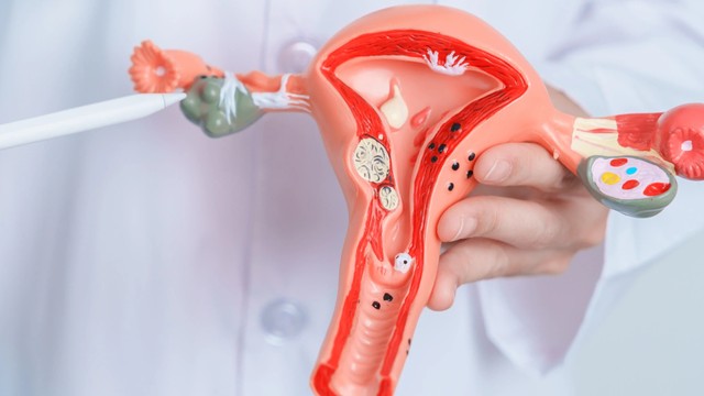 bai-viet/u-bi-buong-trung-kich-thuoc-bao-nhieu-thi-mo-cac-phuong-phap-mo-u-bi-buong-trung.html