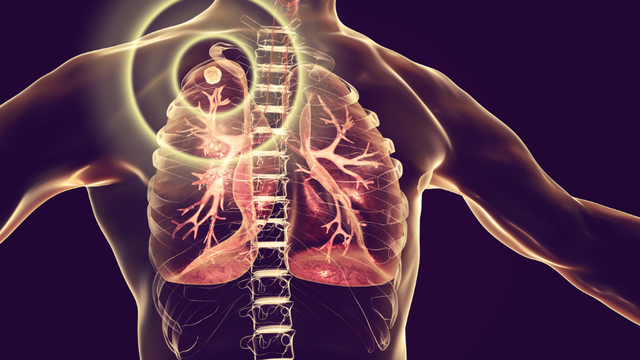 bai-viet/u-lao-la-gi-phan-biet-u-lao-va-ap-xe-lao.html