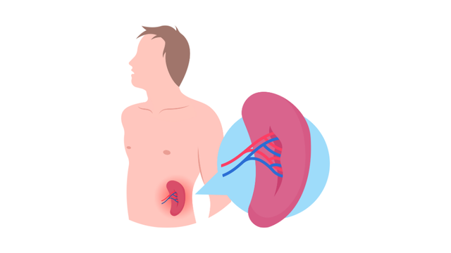 bai-viet/u-mau-lach-la-gi-u-mau-lach-co-nguy-hiem-khong.html