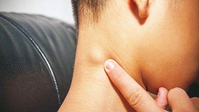 bai-viet/u-nang-bach-huyet-o-tre-em-bien-chung-va-cach-dieu-tri.html