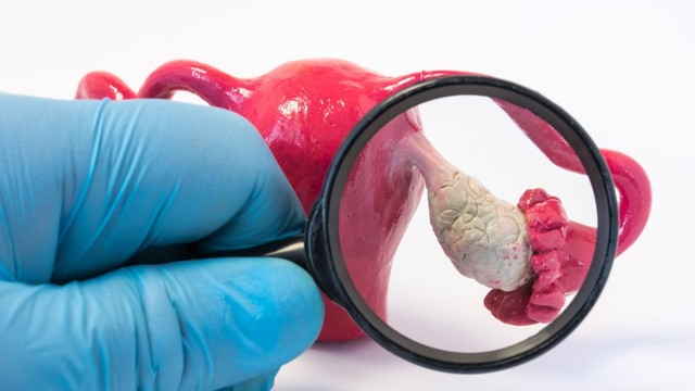 bai-viet/u-nang-don-thuy-buong-trung-co-gay-nguy-hiem-den-tinh-mang-khong.html