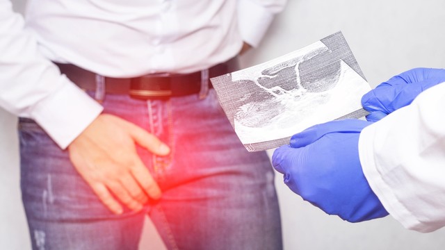 bai-viet/u-nang-mao-tinh-hoan-co-gay-vo-sinh-khong.html