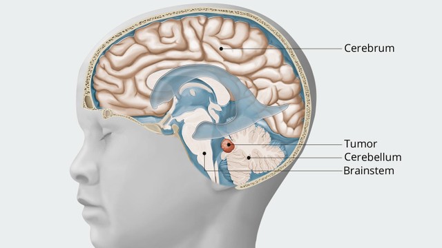 benh/u-nguyen-tuy-bao.html