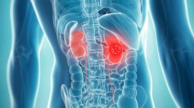 bai-viet/u-than-la-gi-nhung-cach-nhan-biet-va-dieu-tri-u-than-hieu-qua-64623.html