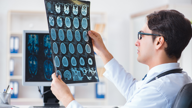  U xơ thần kinh là gì? Nguyên nhân, triệu chứng và cách điều trị