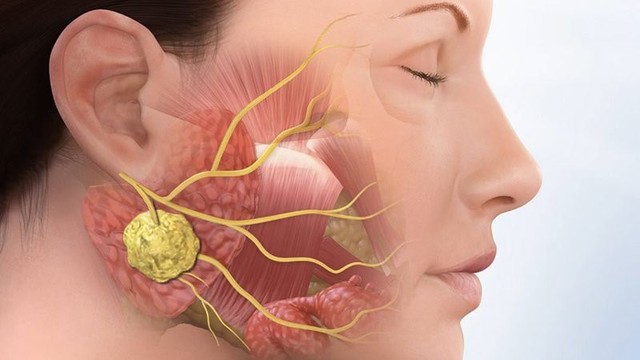 benh/u-xuong-ham.html