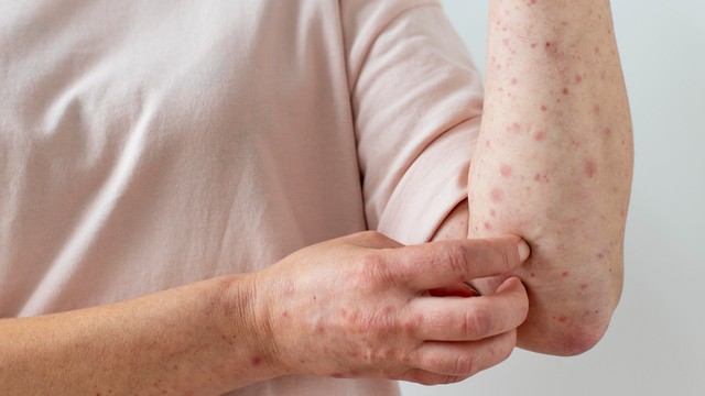 bai-viet/ung-thu-da-co-di-truyen-khong.html