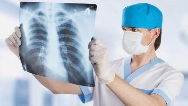 bai-viet/ung-thu-di-can-co-nen-mo-khong-cac-phuong-phap-dieu-tri-ung-thu-di-can.html