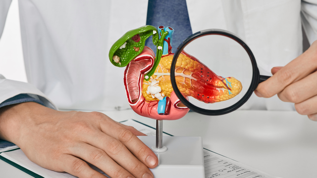 Ung thư đường mật​ là gì? Nguyên nhân, triệu chứng và cách điều trị