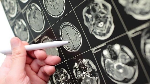 bai-viet/ung-thu-nao-co-chua-duoc-khong-nhung-yeu-to-nao-anh-huong-den-hieu-qua-dieu-tri.html