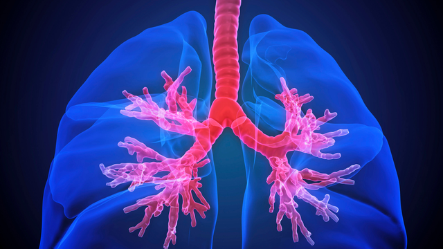 benh/ung-thu-phe-quan-425.html