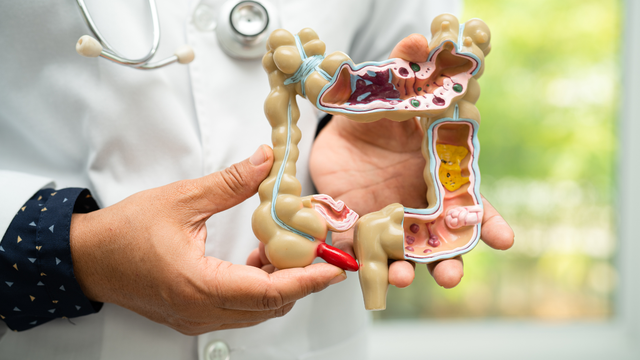 benh/ung-thu-ruot-gia-430.html