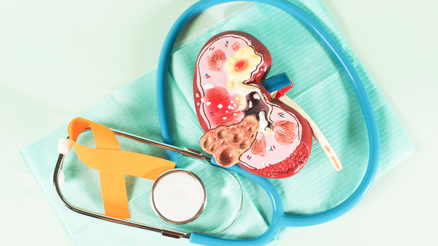 benh/ung-thu-than-431.html